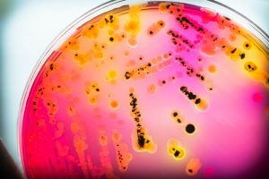 Bacterial growth in a Petri dish