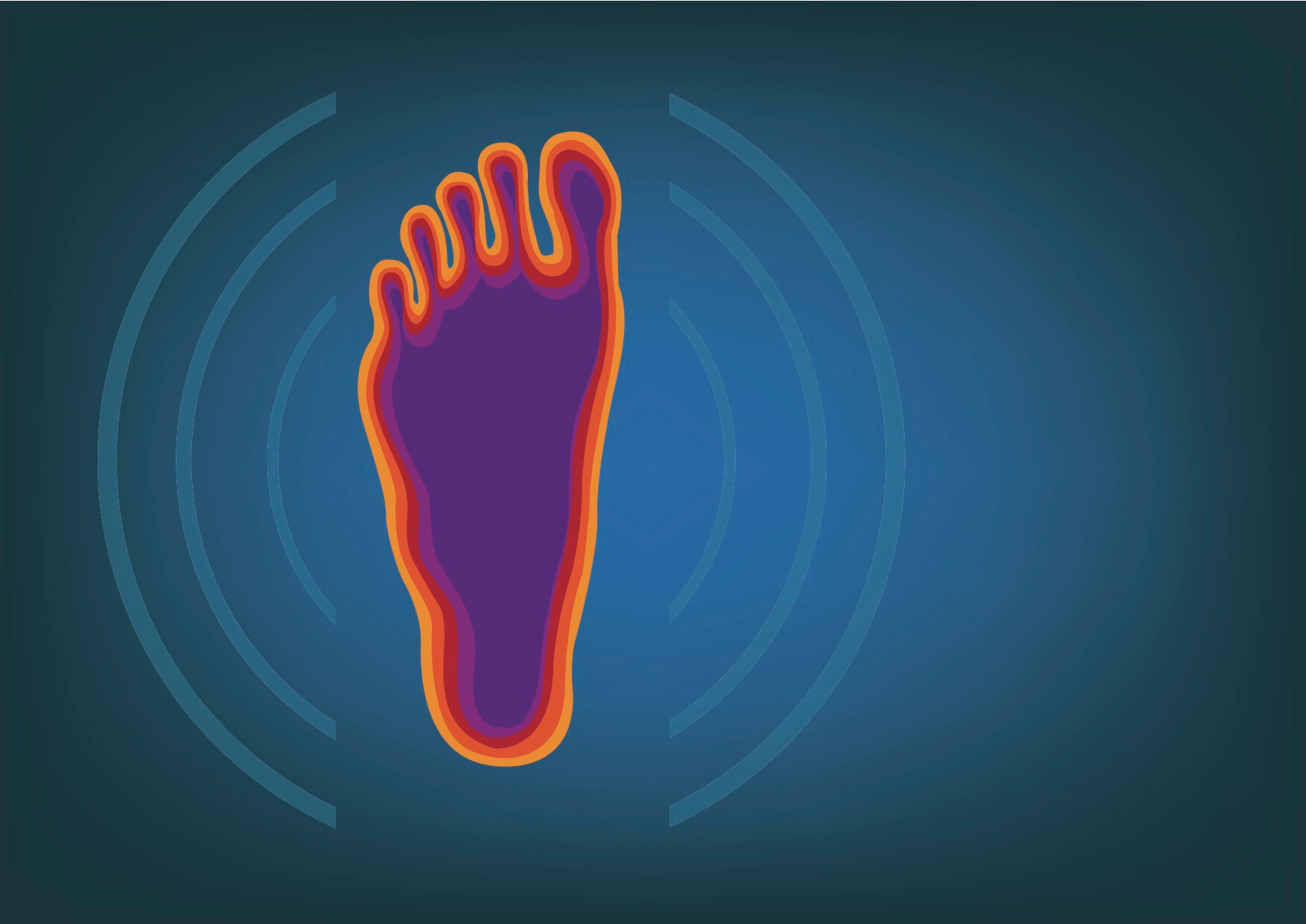 Plantar Fasciitis: Supports, Orthotics, or Walk on your Toes?